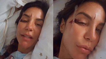 Ivete Sangalo bateu o rosto após desmaiar no banheiro - Foto: Reprodução/ Instagram@ivetesangalo