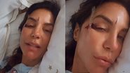 Ivete Sangalo bateu o rosto após desmaiar no banheiro