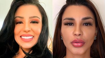 Jenny Miranda mostrou antes e depois de harmonização facial - Foto: Reprodução/ Instagram@jennybritomiranda e CO Assessoria