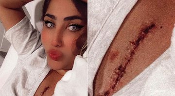 Jéssica Costa exibiu cicatriz de sua terceira cirurgia do coração na web - Foto: Reprodução/ Instagram