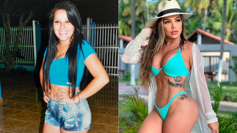 Jéssica Juliane antes e depois de gastar R$ 300 mil em 12 cirurgias plásticas - Foto: Arquivo pessoal