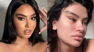 Júlia Medeiros fez lifting facial cirúrgico na Turquia