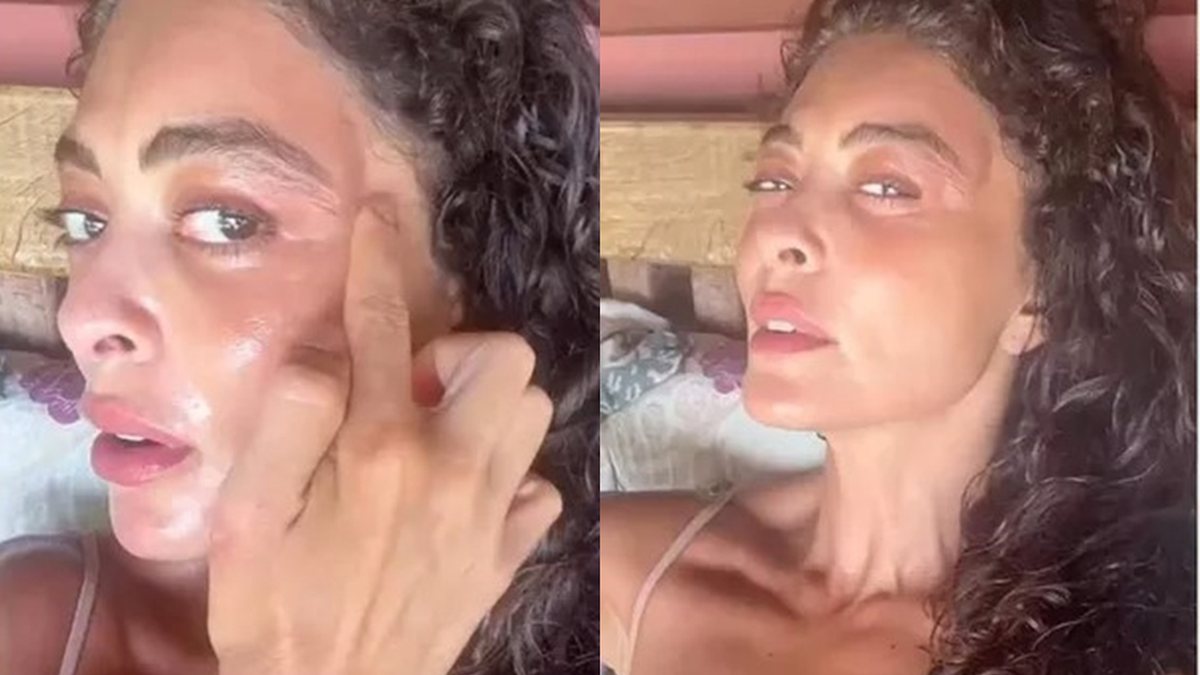 Cenapop · Juliana Paes mostra rosto inchado após picada de inseto e brinca  com situação: 