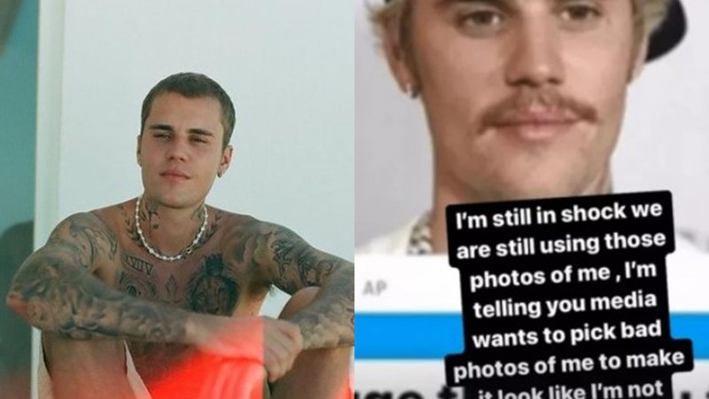 Justin Bieber comenta sobre o uso de suas fotos enquanto passava por tratamento médico - Foto: Reprodução / Instagram @justinbieber