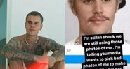 Justin Bieber comenta sobre o uso de suas fotos enquanto passava por tratamento médico - Foto: Reprodução / Instagram @justinbieber