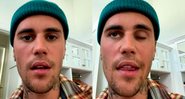 Justin Bieber contou que a fé está ajudando a lidar com paralisia facil - Foto: Reprodução/ Instagram@justinbieber