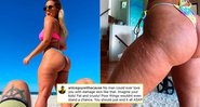 Karina Irby expôs seguidor que a criticou por problema de pele - Foto: Reprodução/ Instagram@karinairby