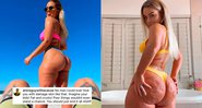 Karina Irby expôs seguidor que a criticou por problema de pele - Foto: Reprodução/ Instagram@karinairby