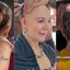 Tratando alopecia, mãe de Lucas Lucco mostra evolução em vídeo: “Muita coisa mudou”