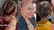 Karina Lucco mostrou evolução da alopecia areata em vídeo
