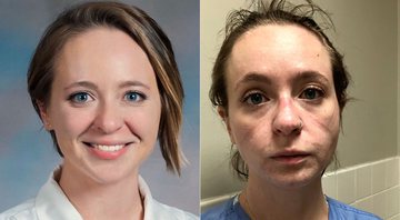 Recém-formada, enfermeira compartilhou as fotos de antes e depois de trabalhar por oito meses em uma ala de Covid - Foto: Reprodução/ Twitter@kathryniveyy