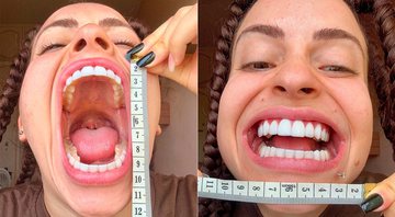 Xehli G quer o recorde de maior abertura de boca do mundo - Foto: Reprodução/ Instagram@xehli