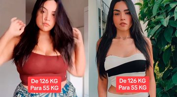 Influencer elimina 71 kg após bariátrica e impressiona com antes e depois: “Vida nova”