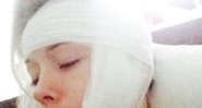 Valeria Lukyanova com o rosto machucado - Créditos: Reprodução/ Twitter