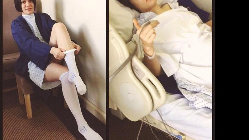 Jessie J antes e depois da cirurgia - Foto: Reprodução/ Instagram