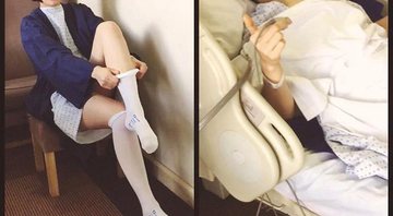 Jessie J antes e depois da cirurgia - Foto: Reprodução/ Instagram