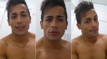 Tiago fala sobre botox malsucedido - Foto: Reprodução/ Facebook
