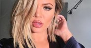 Fãs se incomodam com formato dos lábios de Khloé Kardashian - Foto: Reprodução/Instagram