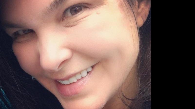 Cristiana Oliveira mostra dente quebrado no Instagram - Foto: Reprodução/ Instagram