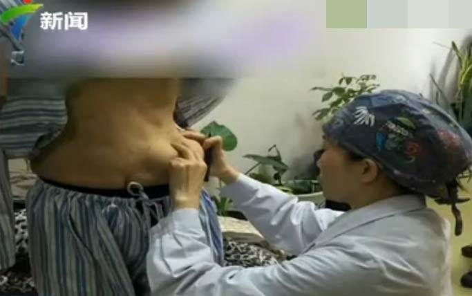 Wang ficou com “seios na barriga” após aplicara o produto - Foto: Reprodução