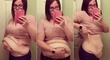 Amanda Roberts eliminou 63 quilos após cirurgia bariátrica - Foto: Reprodução/ Instagram