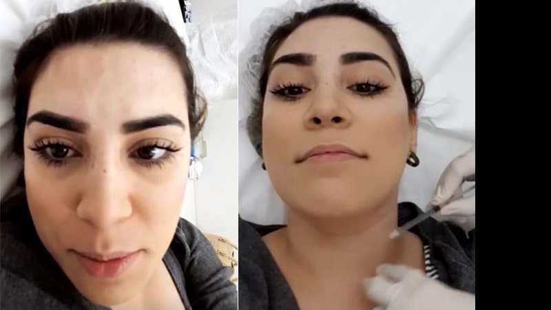 Naiara Azevado retoca o botox e mostra o procedimento em seu snapchat - Foto: Reprodução