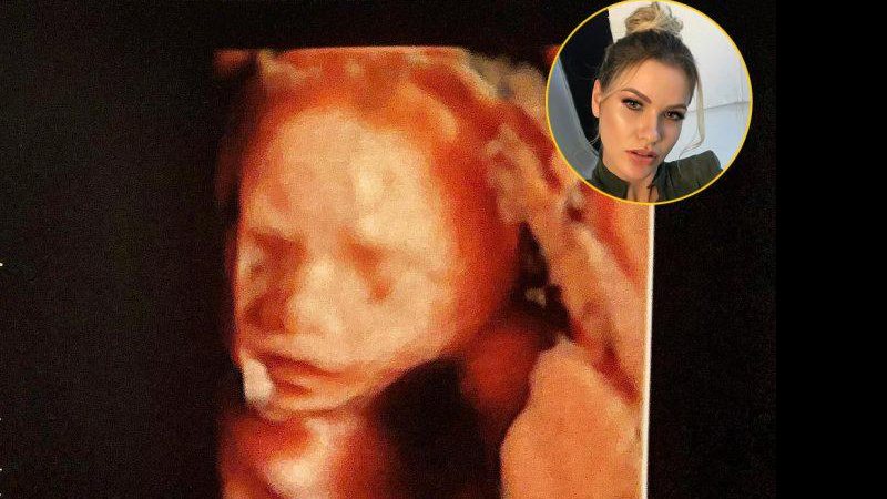 Andressa Suita mostrou o rostinho de Samuel, seu segundo filho, em ultrassom - Foto: Reprodução/ Instagram