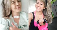 Tânia Oliveira há um ano, após a cirurgia, e atualmente, já curado do câncer na tireoide - Foto: Reprodução/ Instagram