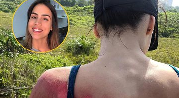 Pérola Faria mostra machucado feio na web após cair de bicicleta - Foto: Reprodução/ Instagram