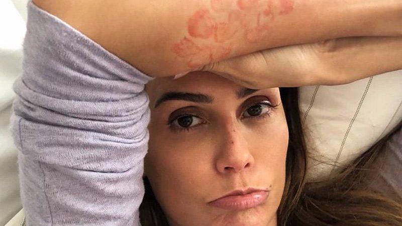 Déborah Secco exibiu o braço cheio de manhas vermelhas na web e pediu a opinião dos internautas - Foto: Reprodução/ Instagram