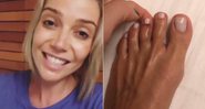 Luiza Possi quebrou o dedinho durante a viagem de lua de mel - Foto: Reprodução/ Instagram