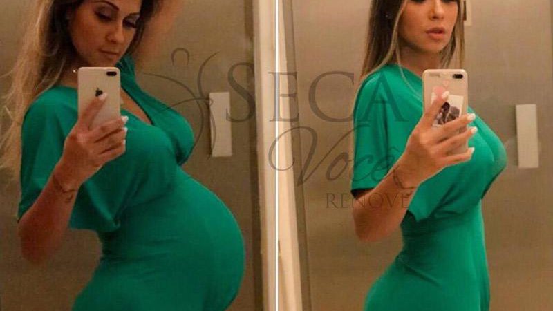 Mayra Cardi mostrou antes e depois incrível 15 dias após dar à luz - Foto: Reprodução/ Instagram