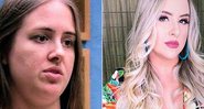 Ex-BBB Patrícia Leitte postou antes e depois após cirurgias - Foto: Reprodução/ Instagram
