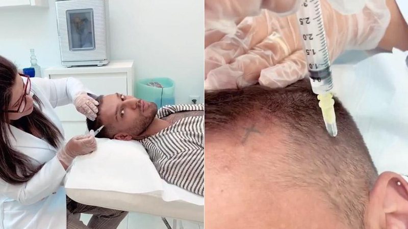 Lucas Lucco mostrou tratamento para prevenir calvice na web - Foto: Reprodução/ Instagram