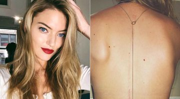 Martha Hunt exibiu cicatriz na web e ganhou o apoio de seus admiradores - Foto: Reprodução/ Instagram