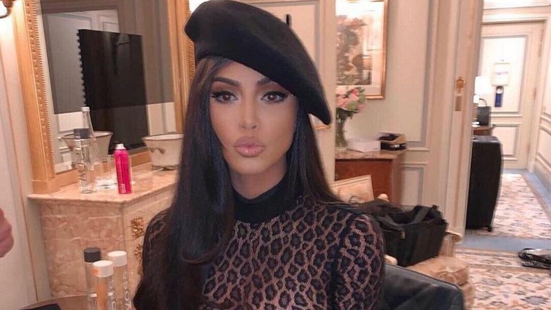 Kim Kardashian é uma das celebridades que sofrem de psoríase - Foto: Reprodução/Instagram