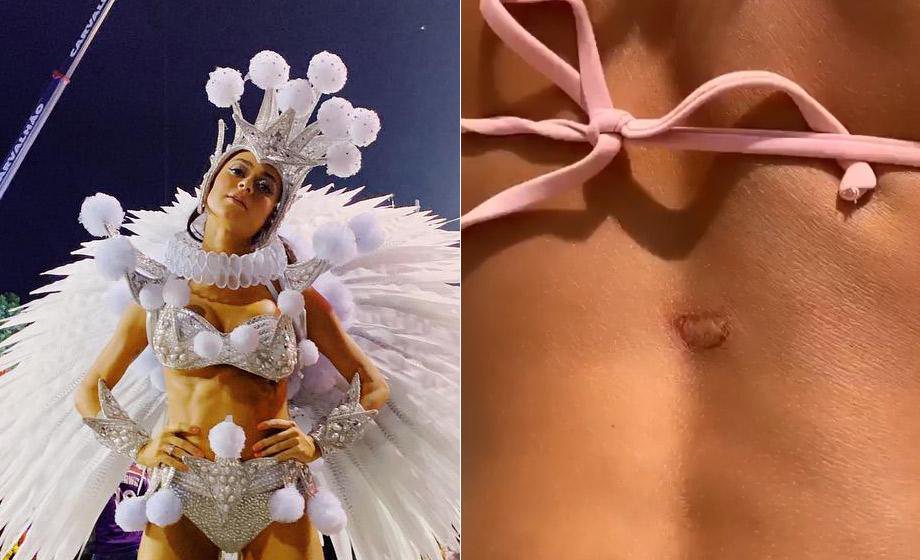 Cenapop · Modelo viraliza ao exibir corpo real com estrias e celulites em  desfile: “Linda e natural”
