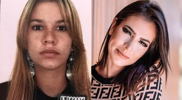 Adriana Sant’Anna antes e depois de cirurgia plástica no nariz - Foto: Reprodução/ Instagram