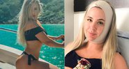 Patrícia Leitte passou por uma bichectomia e também fez uma lipoaspiração para remover a papada - Foto: Reprodução/ Instagram