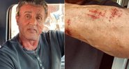 Sylvester Stallone machucou o braço durante cena de ação em caverna - Foto: Reprodução/ Instagram
