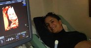 Através do ultrassom, Cláudia Leitte revela rosto de sua filhinha, Bela - Foto: Reprodução/Instagram