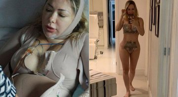 Ju Isen mostra o corpo um mês após série de cirurgias plásticas - Foto: Reprodução/ Instagram