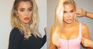 Khloé Kardashian antes e depois das supostas plásticas no rosto - Foto: Reprodução/ Instagram