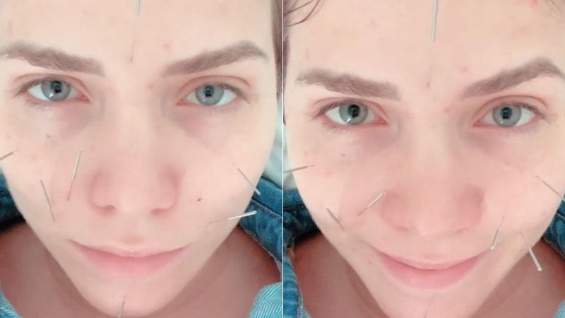Letícia Colin contou que continua com a acupuntura durante a gestação - Foto: Reprodução/ Instagram