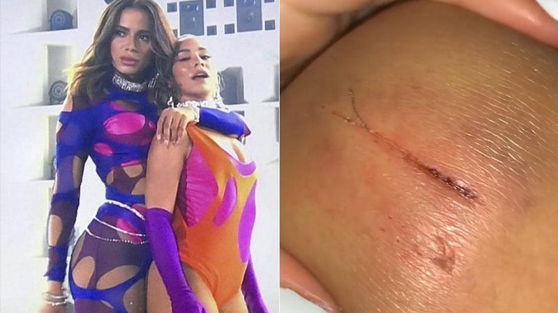 Ohana Lefundes cortou o joelho ao esbarrar em cenário no palco do Rock in Rio - Foto: Reprodução/ Instagram