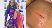 Ohana Lefundes cortou o joelho ao esbarrar em cenário no palco do Rock in Rio - Foto: Reprodução/ Instagram