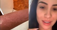 Bianca Andrade, conhecida como Boca Rosa, se confundiu na hora de pegar um bronzeado - Foto: Reprodução/Instagram