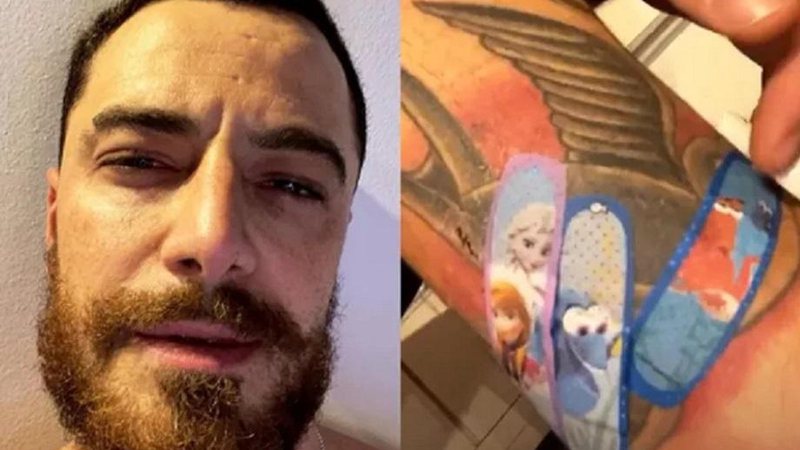 Felipe Titto mostra curativos e processo de cicatrização na perna após mordida de cachorro - Foto: Reprodução/Instagram