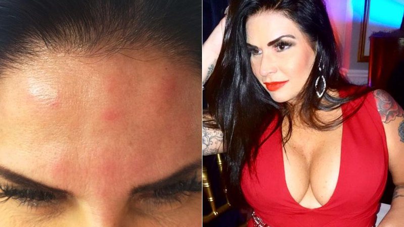 Solange Gomes disse que botox gerou reação alérgica - Foto: Reprodução/ Instagram