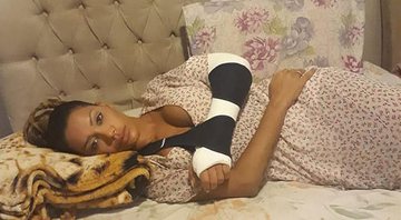 Ana Paula Evangelista quebrou o punho após confusão no Bloco da Favorita - Foto: Reprodução/ Instagram